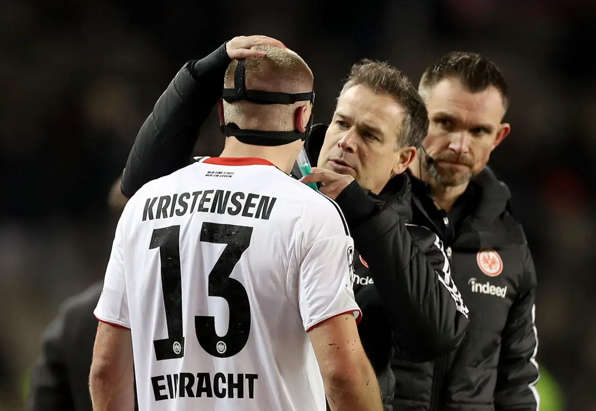 Eintracht Frankfurt defender Rasmus Kristensen receiving medical treatment for his broken nose during Thursday's Champions League fixture.